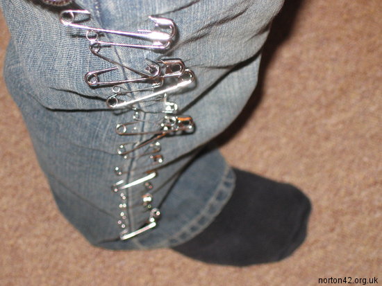 Shot of my leg with many safety pins